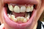 orthodontic.jpg