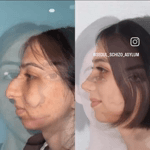 VID_20251104_081000_098.mp4 VID_20251104_081000_098.mp4